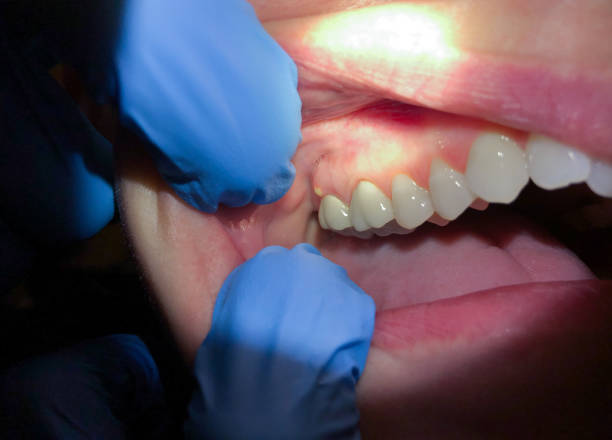  Folsom, NJ Emergency Dentist Pros
